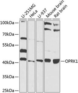 Western blot - OPRK1 antibody (A8306)