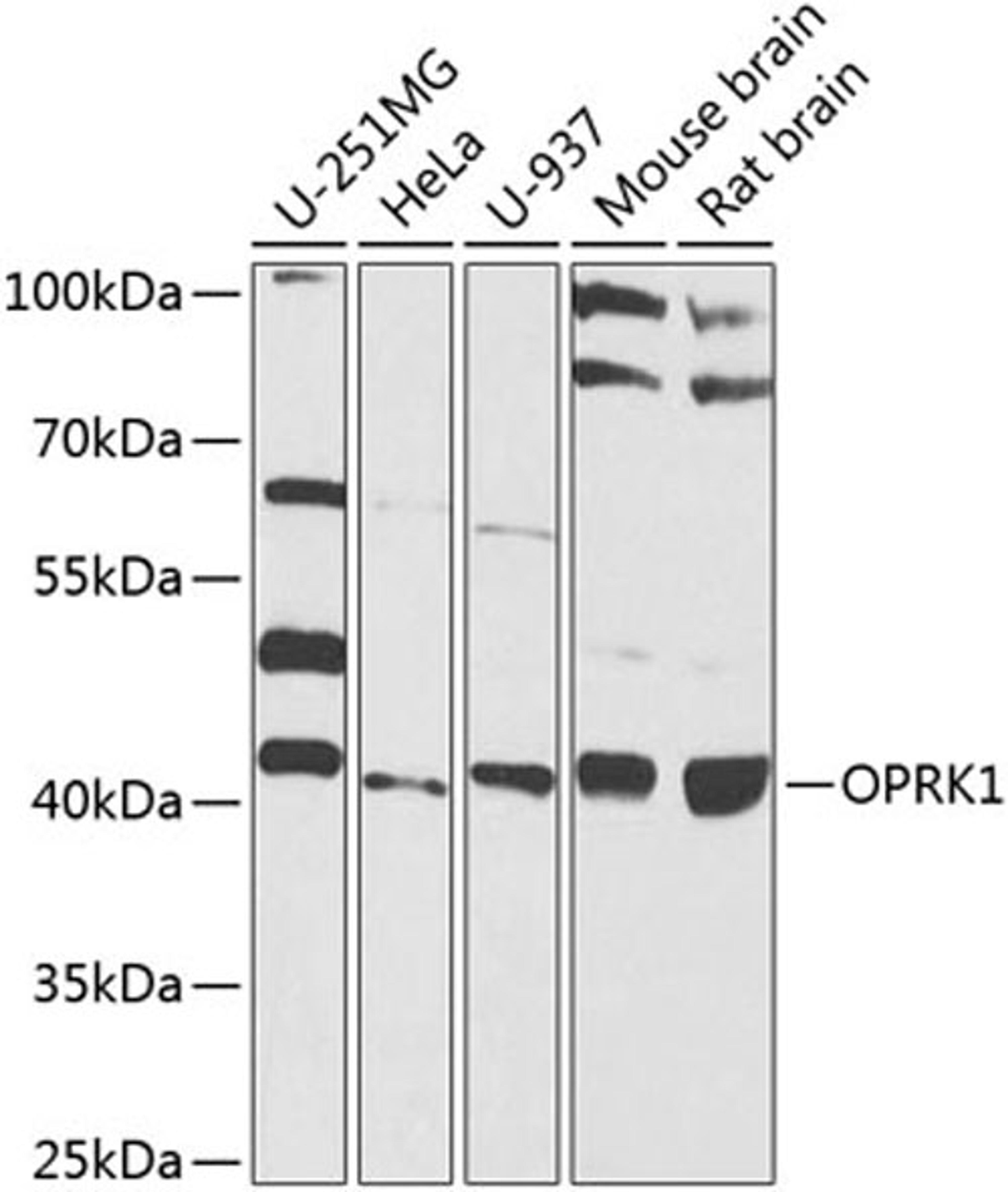 Western blot - OPRK1 antibody (A8306)