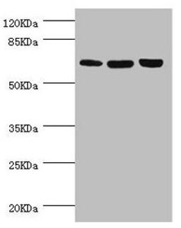 Western blot. All lanes: CTNNBL1 antibody at 5.39µg/ml. Lane 1: Hela whole cell lysate. Lane 2: Jurkat whole cell lysate. Lane 3: 293T whole cell lysate. Secondary. Goat polyclonal to rabbit IgG at 1/10000 dilution. Predicted band size: 66, 44, 37, 62 kDa. Observed band size: 66 kDa