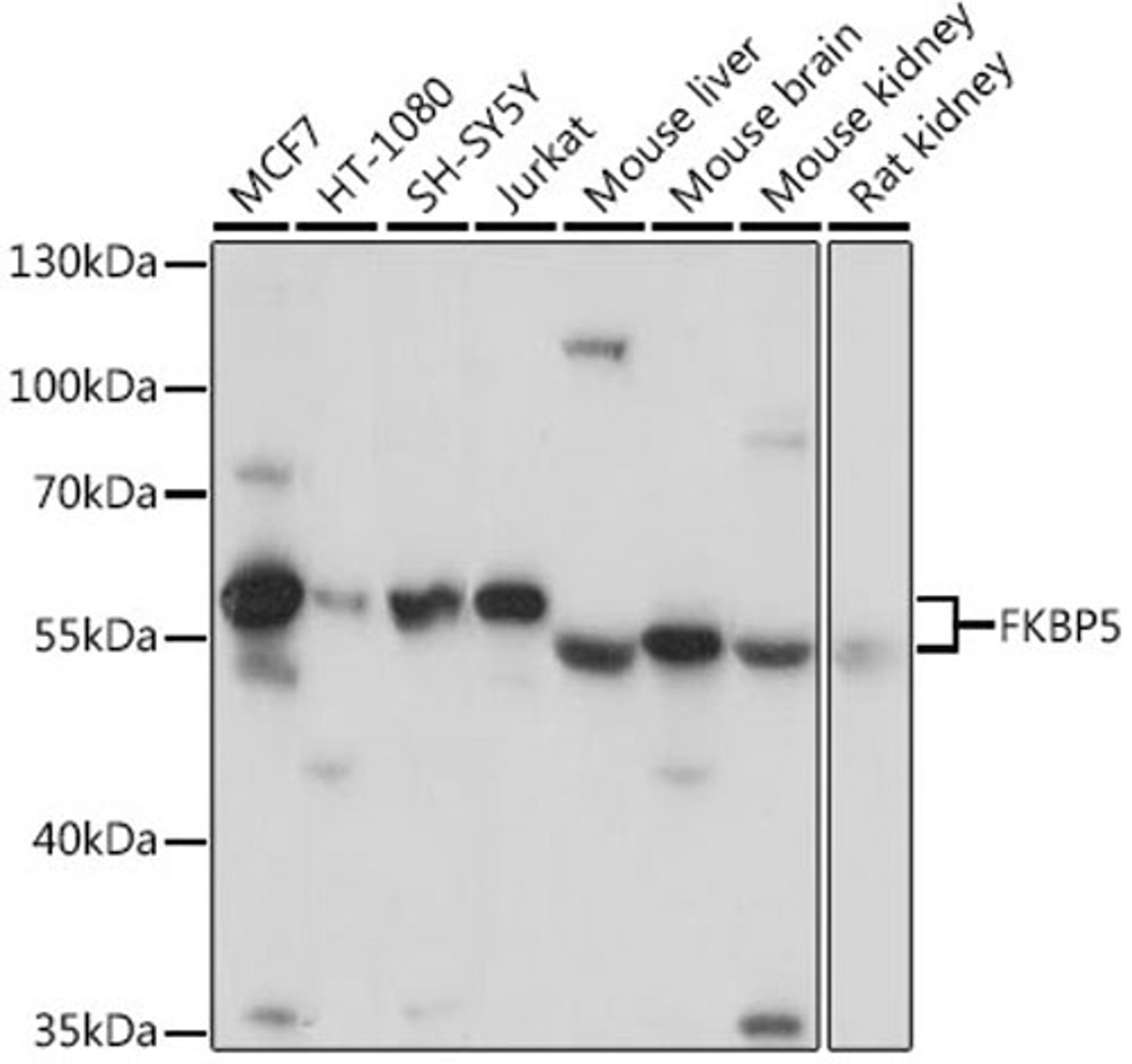 Western blot - FKBP5 antibody (A3863)