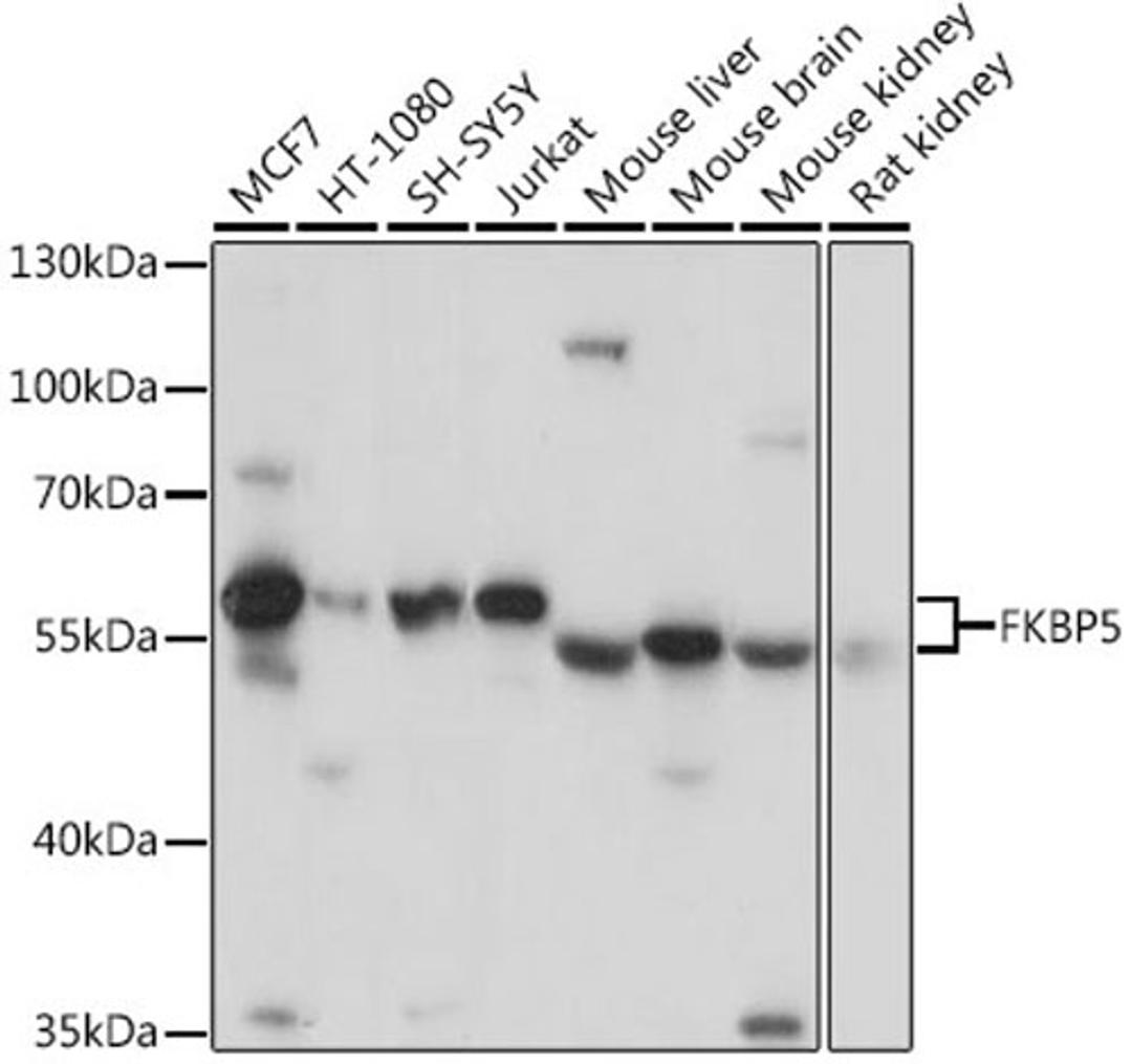 Western blot - FKBP5 antibody (A3863)