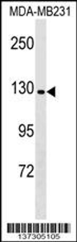 Western blot analysis in MDA-MB231 cell line lysates (35ug/lane).