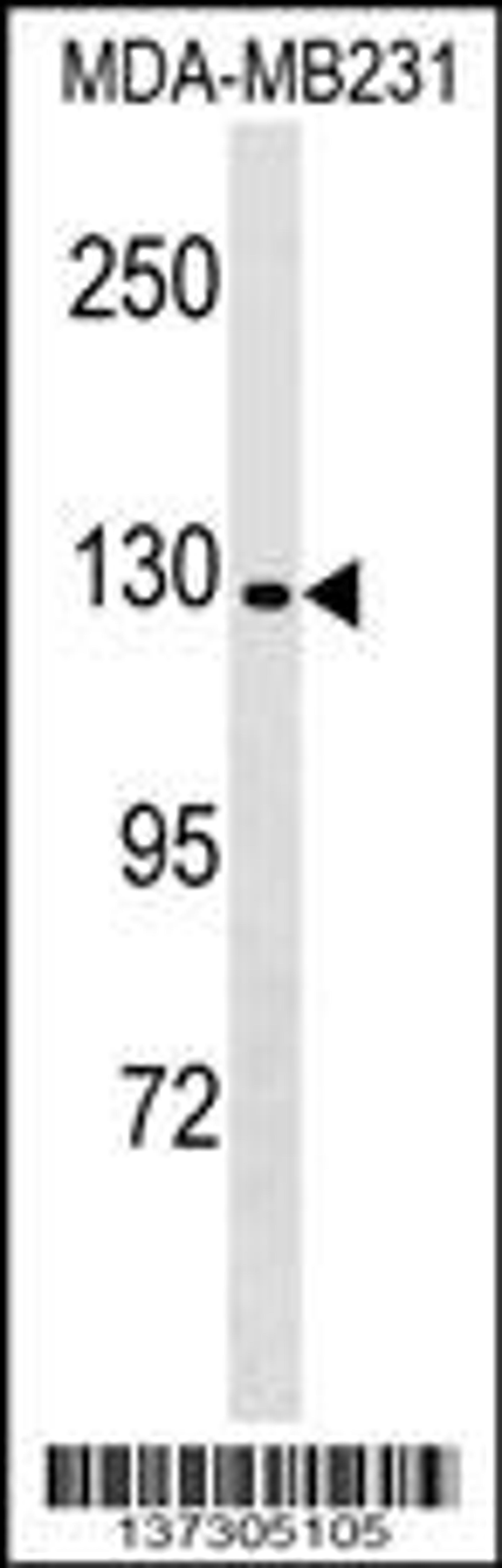 Western blot analysis in MDA-MB231 cell line lysates (35ug/lane).