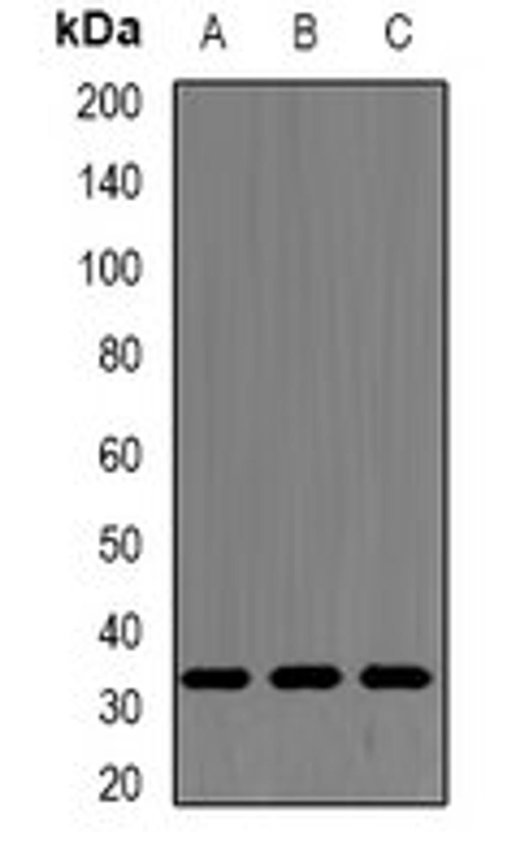 Western blot analysis of MCF7 (Lane1), A549 (Lane2), mouse spleen (Lane3) whole cell lysates using SRSF1 antibody