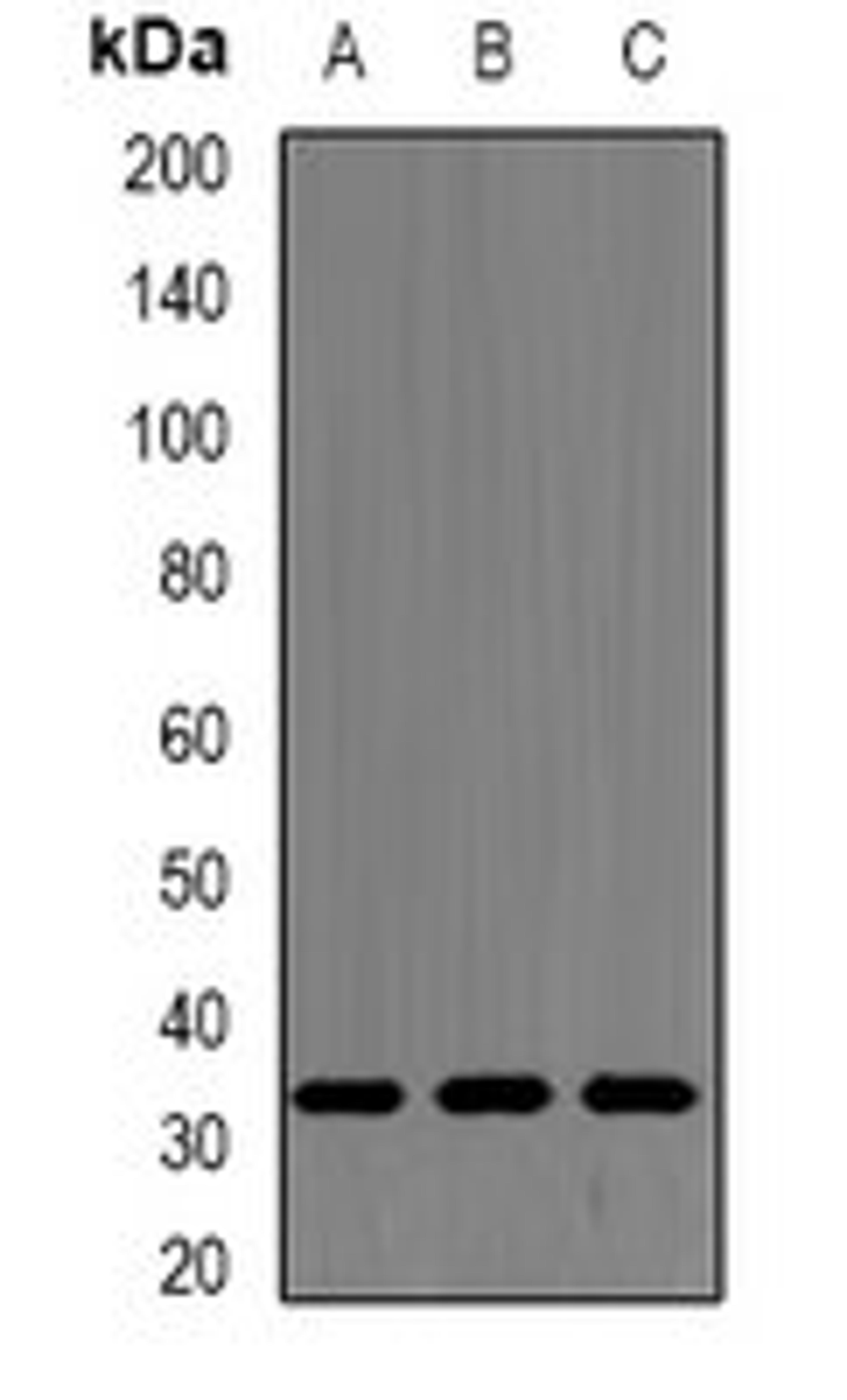 Western blot analysis of MCF7 (Lane1), A549 (Lane2), mouse spleen (Lane3) whole cell lysates using SRSF1 antibody