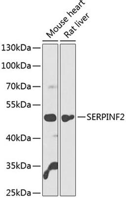 Western blot - SERPINF2 antibody (A14043)