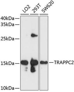 Western blot - TRAPPC2 antibody (A10465)