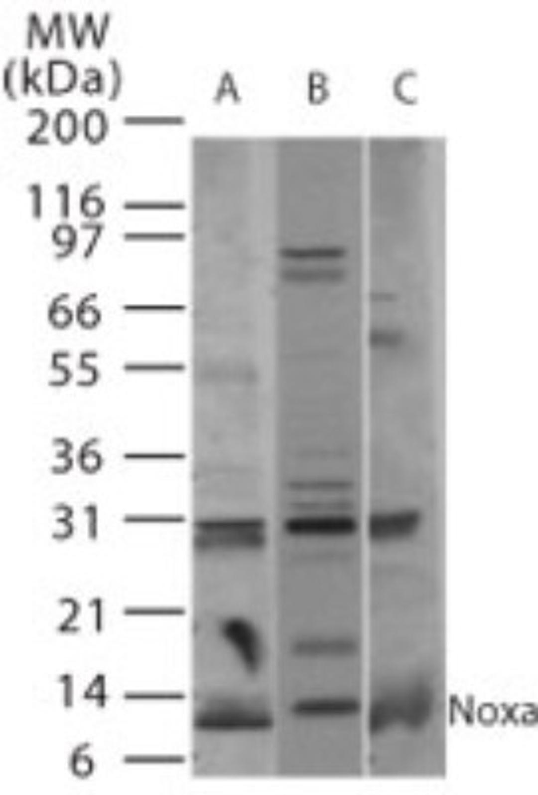 Western Blot: Noxa Antibody [NB100-56368] - Western blot analysis of Noxa in A) human, B) mouse, and C) rat thymus tissue using NB100-56368 at 2 ug/ml.