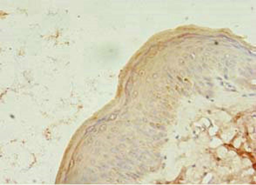 Immunohistochemistry of paraffin-embedded human skin tissue using CSB-PA874804LA01HU at dilution of 1:100
