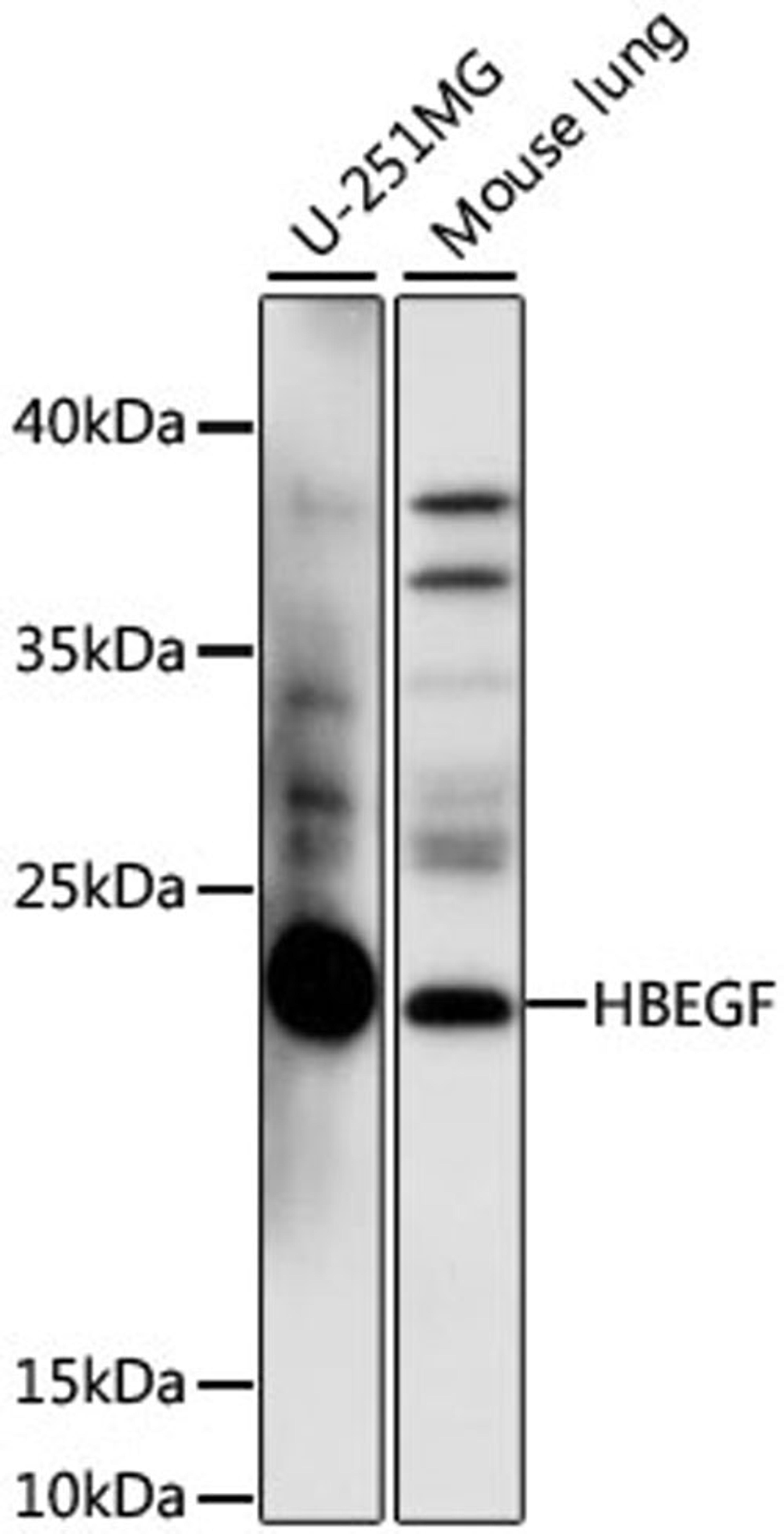 Western blot - HBEGF antibody (A16365)