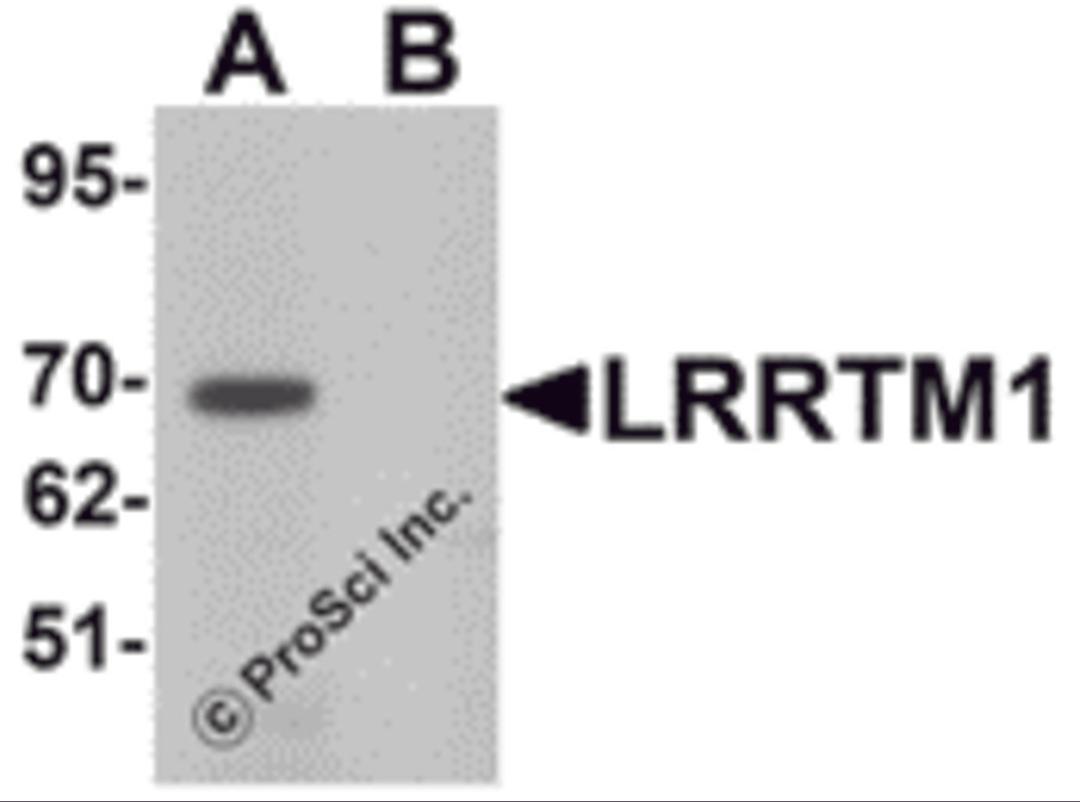 Western blot analysis of LRRTM1 in mouse brain tissue lysate with LRRTM1 antibody at 1 μg/mL in (A) the absence and (B) the presence of blocking peptide.