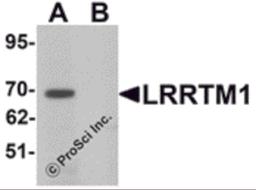 Western blot analysis of LRRTM1 in mouse brain tissue lysate with LRRTM1 antibody at 1 μg/mL in (A) the absence and (B) the presence of blocking peptide.