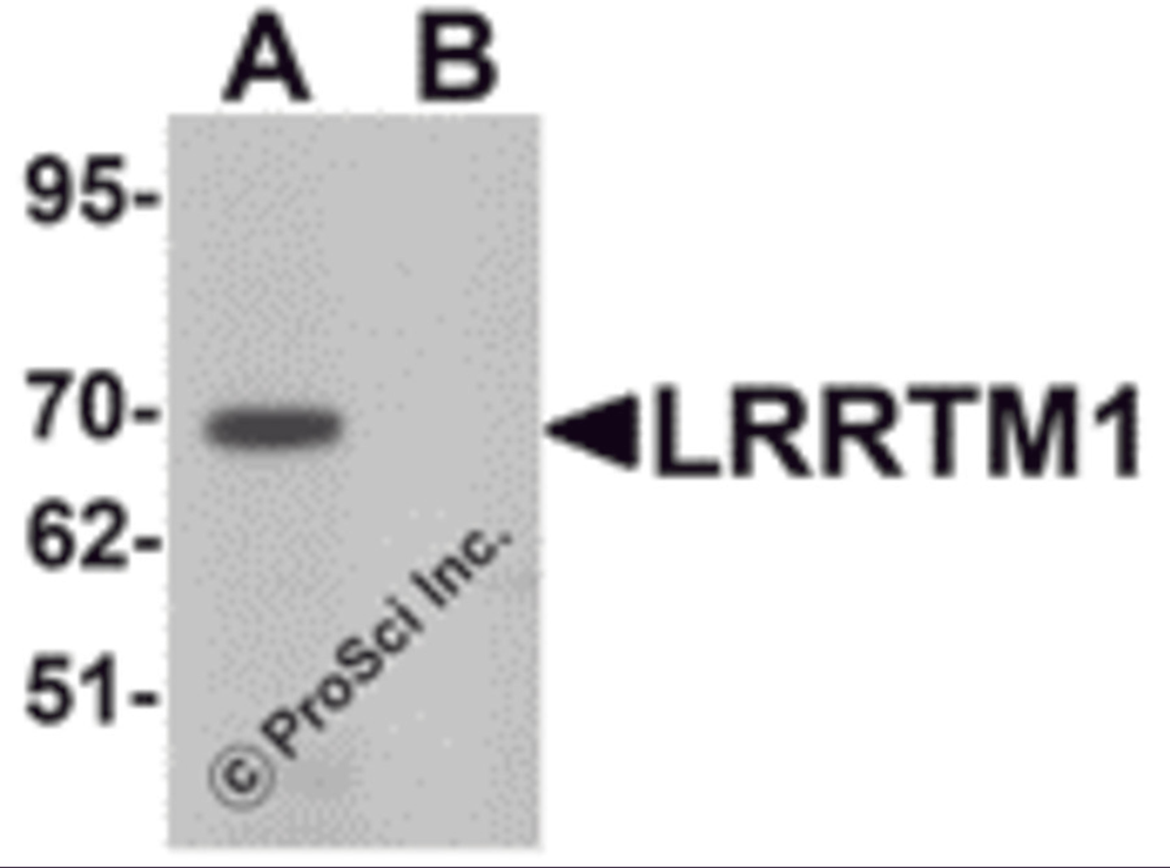 Western blot analysis of LRRTM1 in mouse brain tissue lysate with LRRTM1 antibody at 1 μg/mL in (A) the absence and (B) the presence of blocking peptide.