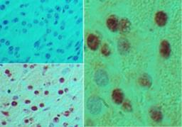 Immunohistochemistry-Paraffin: MNX1/HLXB9 Antibody [NBP2-24691] - Analysis of HB9 in formalin-fixed, paraffin-embedded mouse pancreas tissue using an isotype control (top left) and this antibody (bottom left, right) at 5 ug/ml.