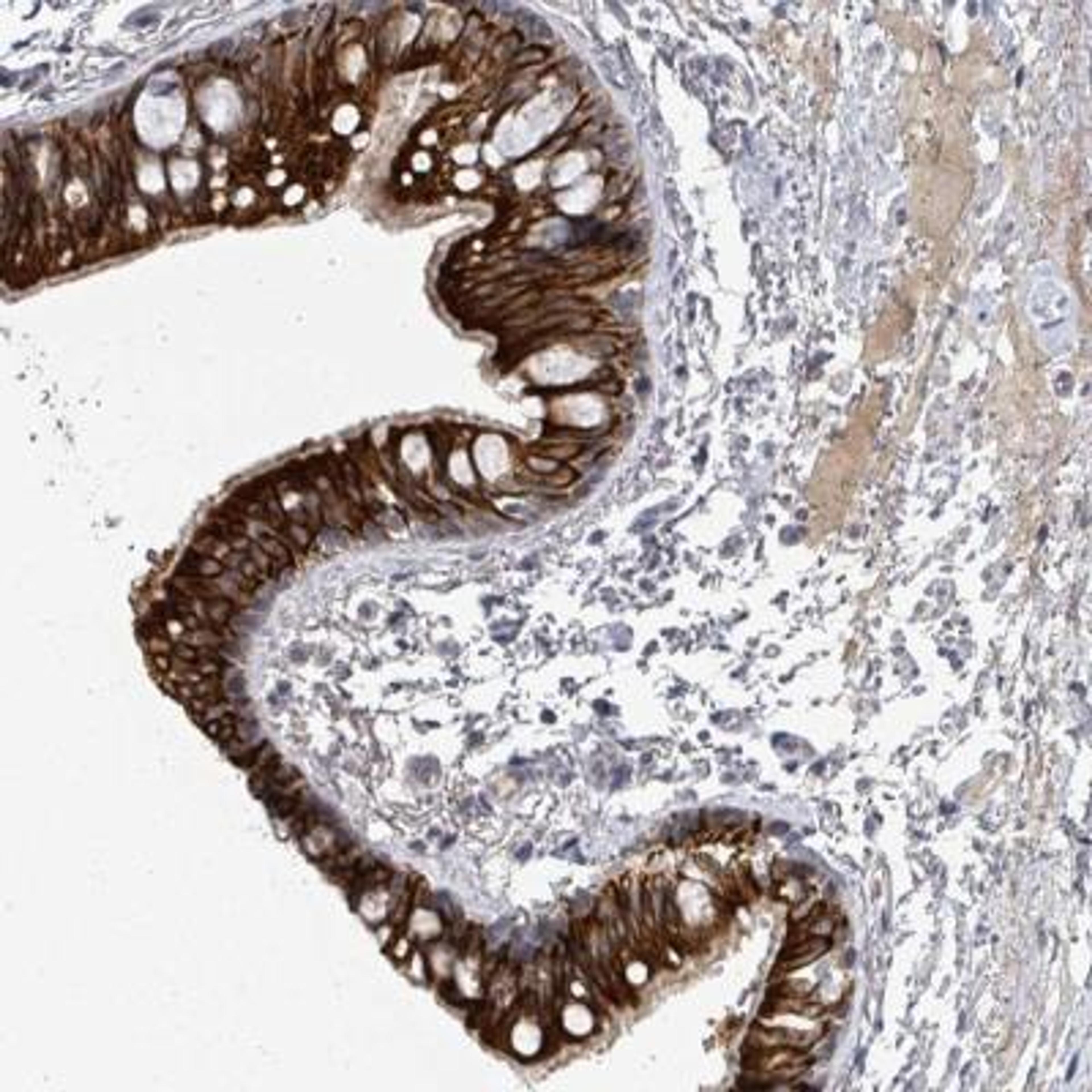 Immunohistochemistry: PTPN20A Antibody [NBP2-46761] - Analysis of human bronchus shows strong cytoplasmic and membranous positivity in respiratory epithelial cells.