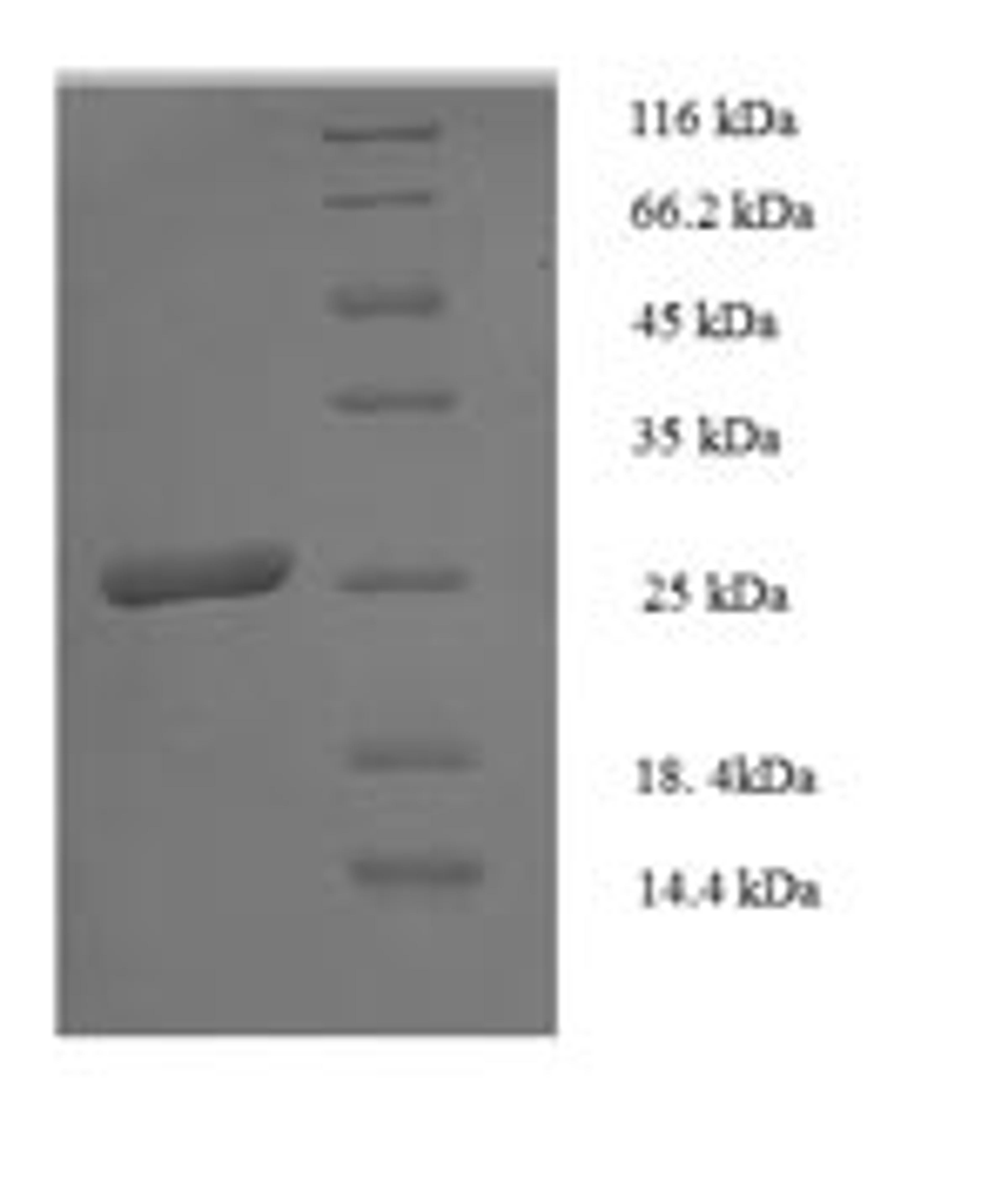 (Tris-Glycine gel) Discontinuous SDS-PAGE (reduced) with 5% enrichment gel and 15% separation gel.