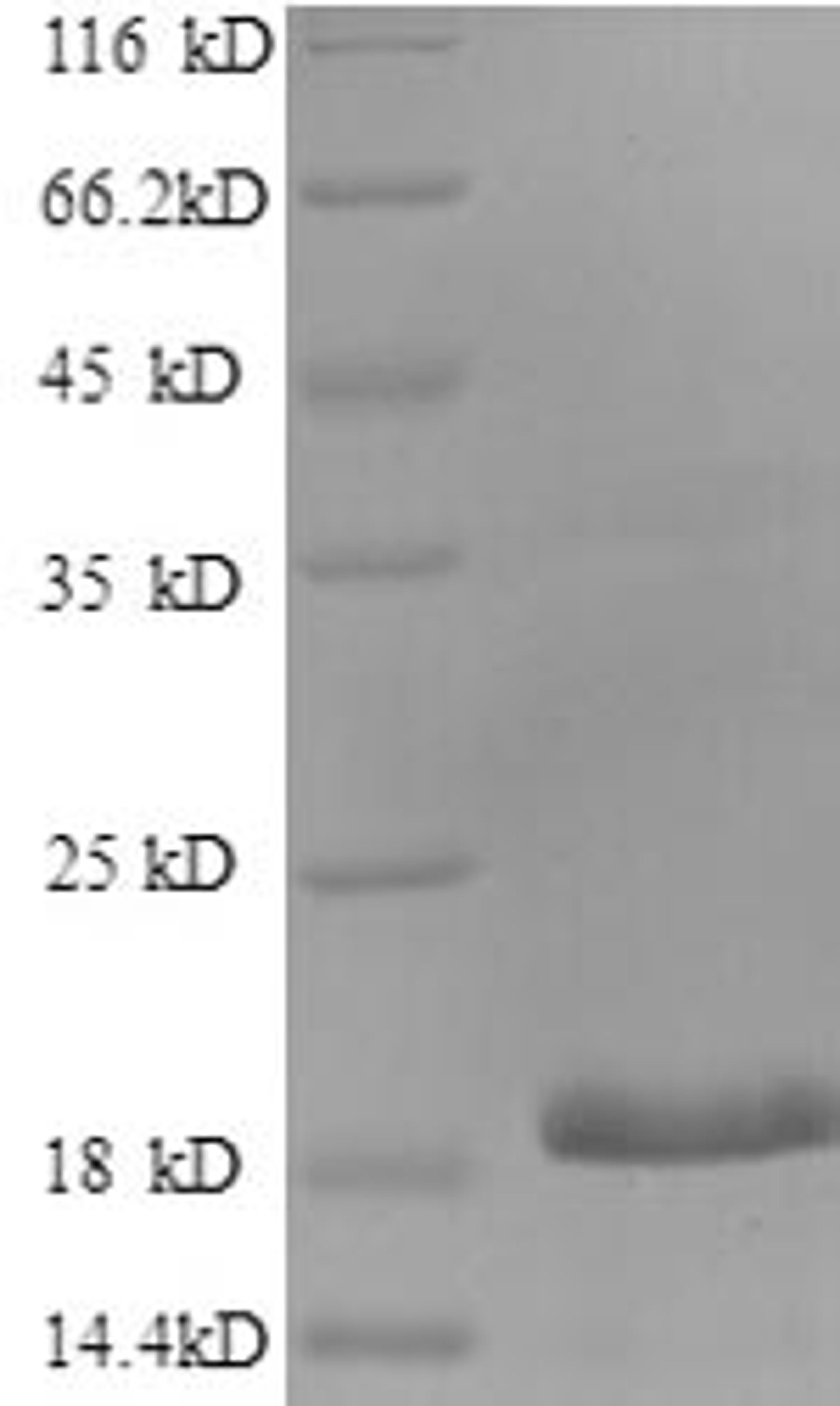 (Tris-Glycine gel) Discontinuous SDS-PAGE (reduced) with 5% enrichment gel and 15% separation gel.