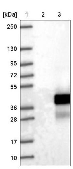 Western Blot: LURAP1 Antibody [NBP1-83569] - Lane 1: Marker [kDa] 250, 130, 95, 72, 55, 36, 28, 17, 10<br/>Lane 2: Negative control (vector only transfected HEK293T lysate)<br/>Lane 3: Over-expression lysate (Co-expressed with a C-terminal myc-DDK tag (~3.1 kDa) in mammalian HEK293T cells, LY422980)