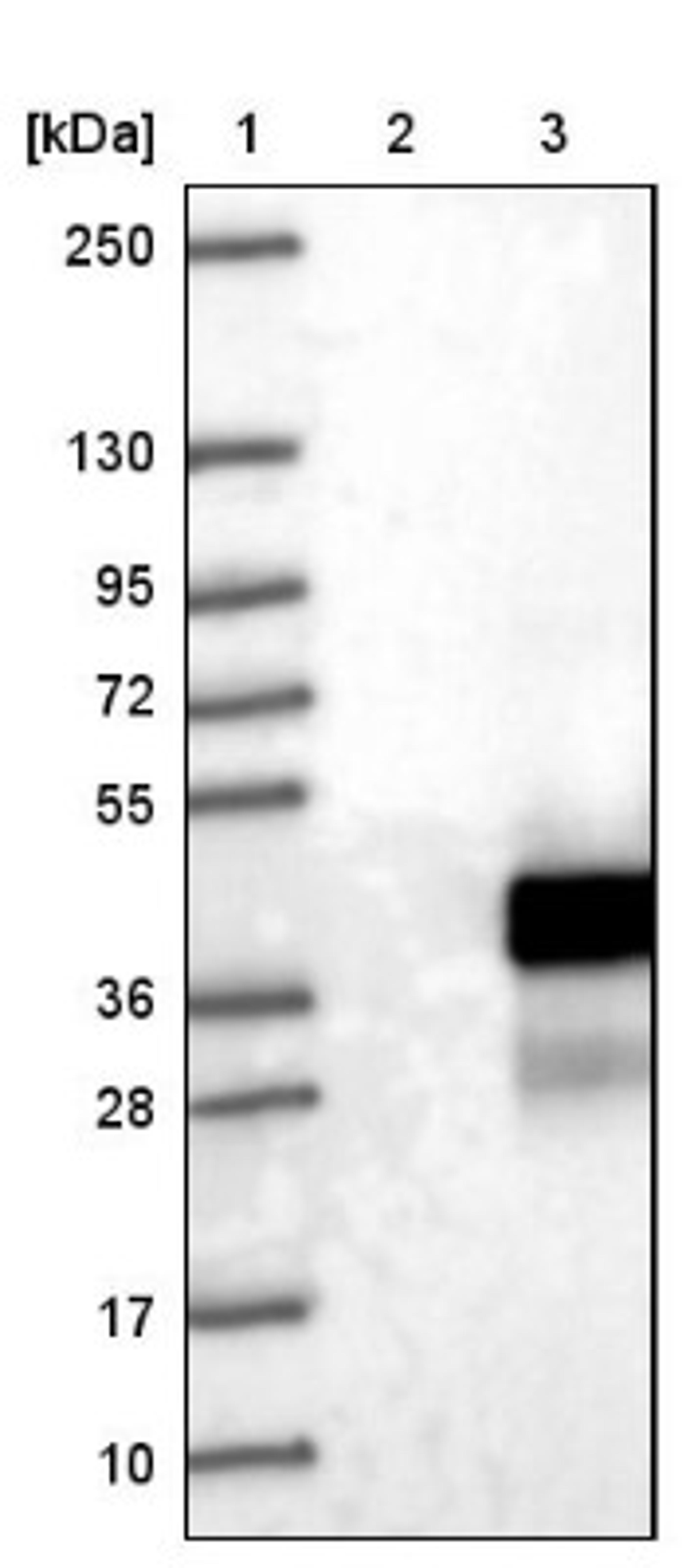 Western Blot: LURAP1 Antibody [NBP1-83569] - Lane 1: Marker [kDa] 250, 130, 95, 72, 55, 36, 28, 17, 10<br/>Lane 2: Negative control (vector only transfected HEK293T lysate)<br/>Lane 3: Over-expression lysate (Co-expressed with a C-terminal myc-DDK tag (~3.1 kDa) in mammalian HEK293T cells, LY422980)