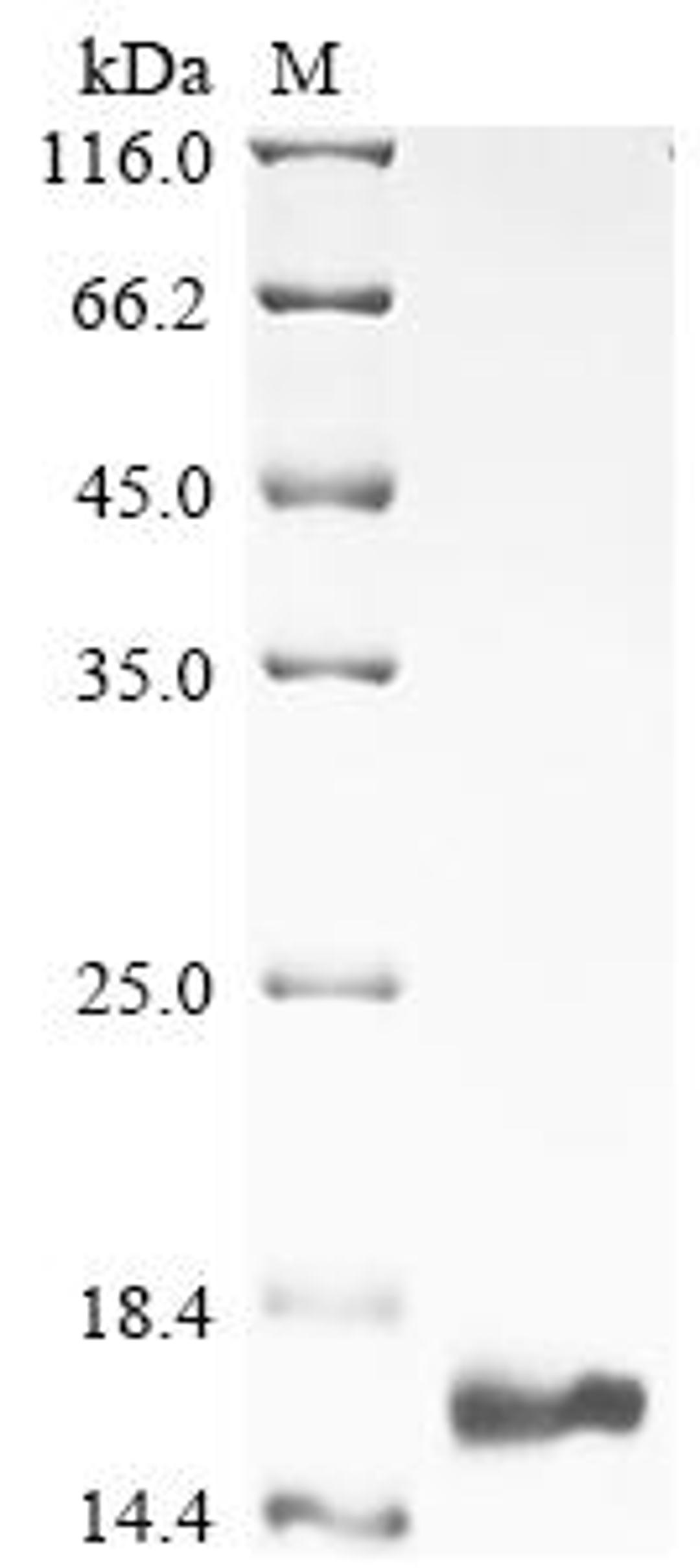 (Tris-Glycine gel) Discontinuous SDS-PAGE (reduced) with 5% enrichment gel and 15% separation gel.