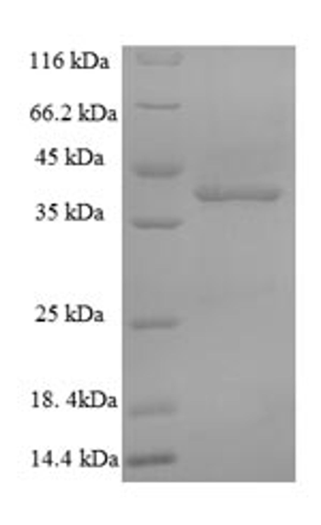 (Tris-Glycine gel) Discontinuous SDS-PAGE (reduced) with 5% enrichment gel and 15% separation gel.