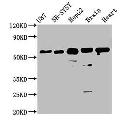 Western Blot. Positive WB detected in: U87 whole cell lysate, SH-SY5Y whole cell lysate, HepG2 whole cell lysate, Mouse brain tissue, Rat heart tissue. All lanes: CPNE7 antibody at 3.6µg/ml. Secondary. Goat polyclonal to rabbit IgG at 1/50000 dilution. Predicted band size: 71, 62 kDa. Observed band size: 62 kDa