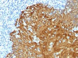 Immunohistochemical staining of human Skin tissue using KRT77 and KRT76 antibody