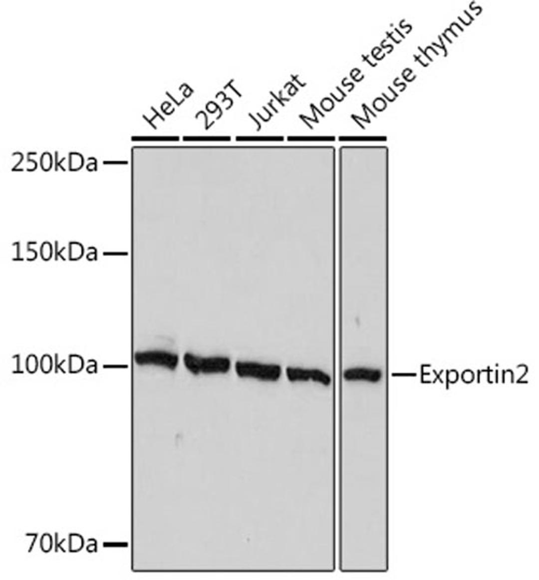 Western blot - Exportin2 Rabbit mAb (A1041)