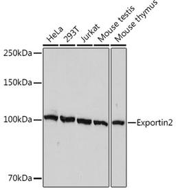 Western blot - Exportin2 Rabbit mAb (A1041)