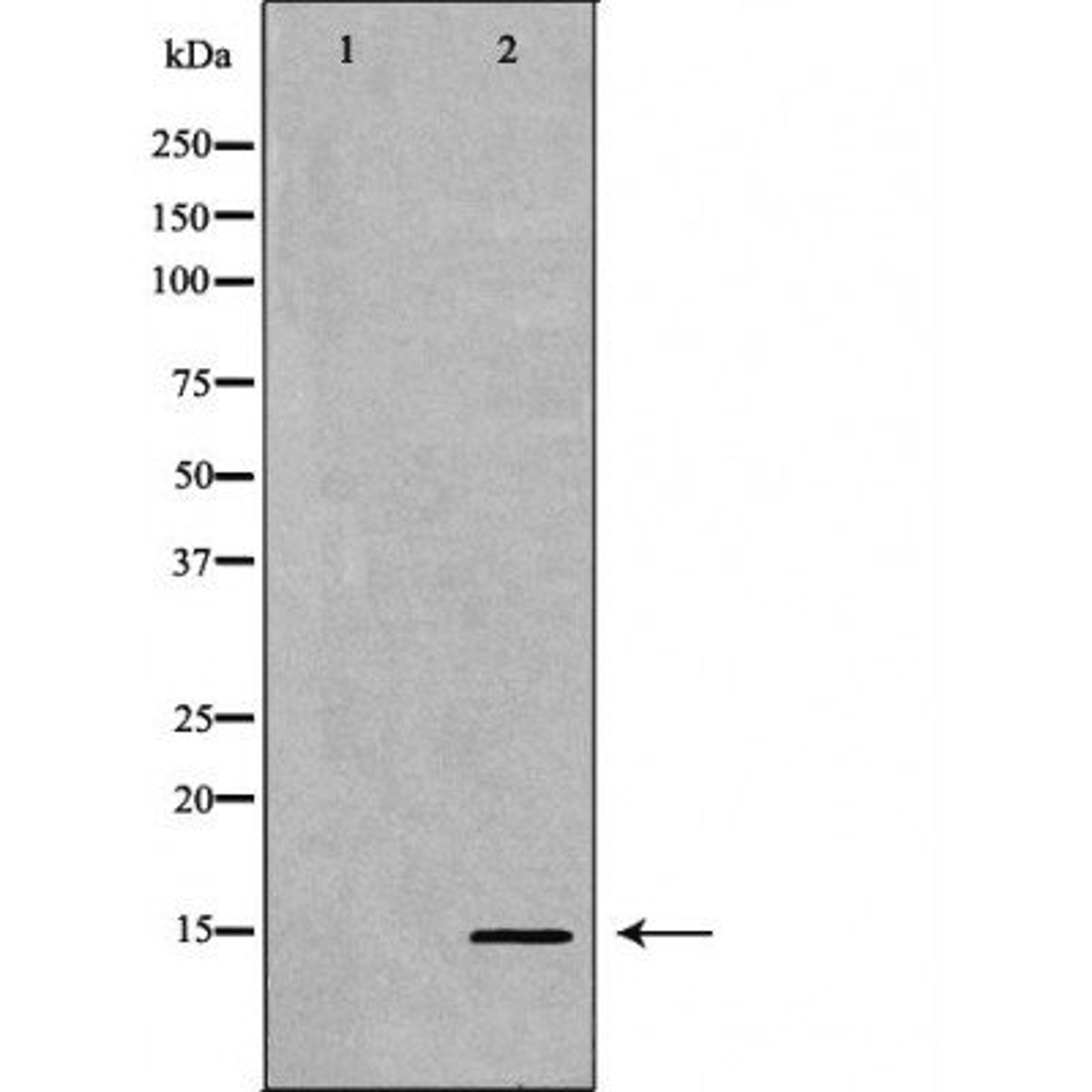 Western blot analysis of HeLa cell line and H3 protein expressed in E.coli using H3K9me3 antibody