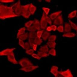 Immunofluorescent analysis of HeLa cells using LCP1 antibody