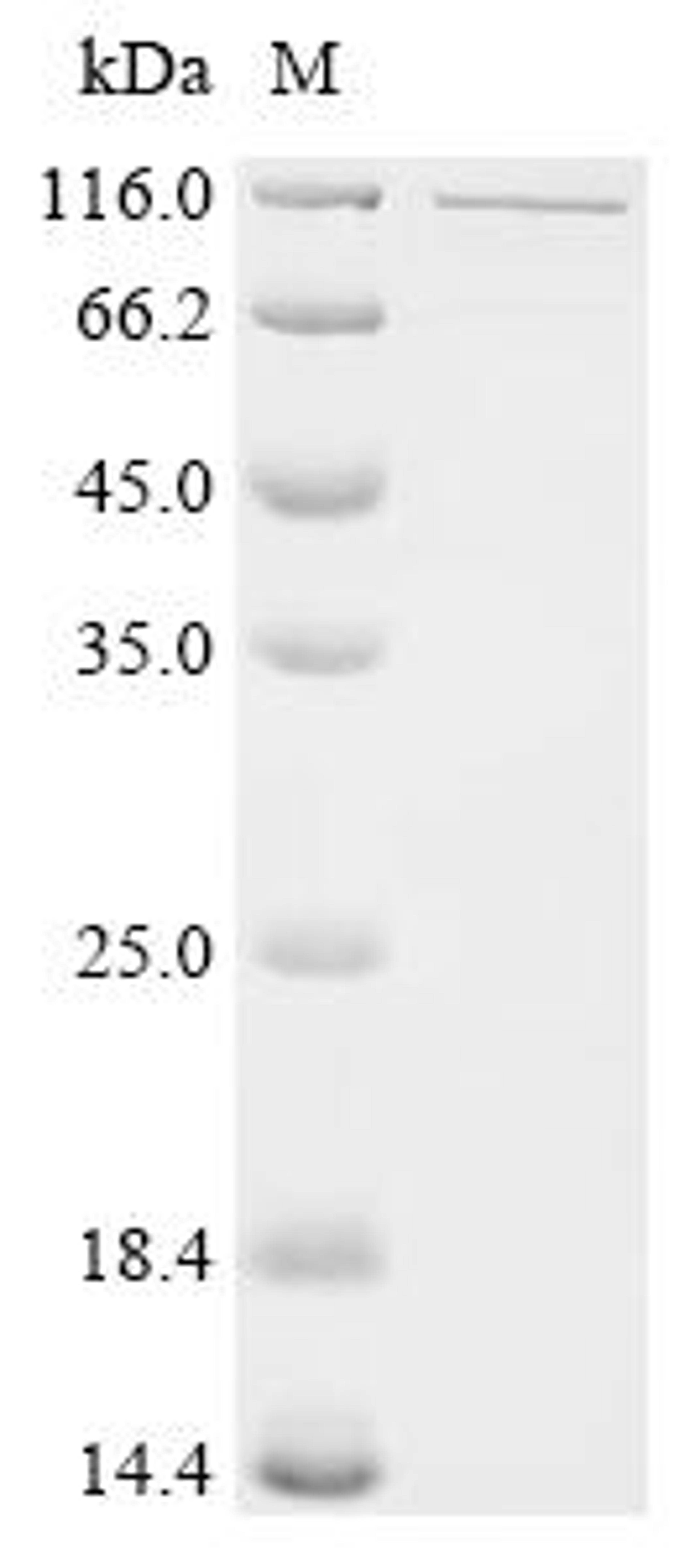 (Tris-Glycine gel) Discontinuous SDS-PAGE (reduced) with 5% enrichment gel and 15% separation gel.