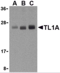 Western blot analysis of TL1A in PC-3 cell lysates with TL1A antibody at (A) 0.5, (B) 1, and (C) 2 &#956;g/mL.