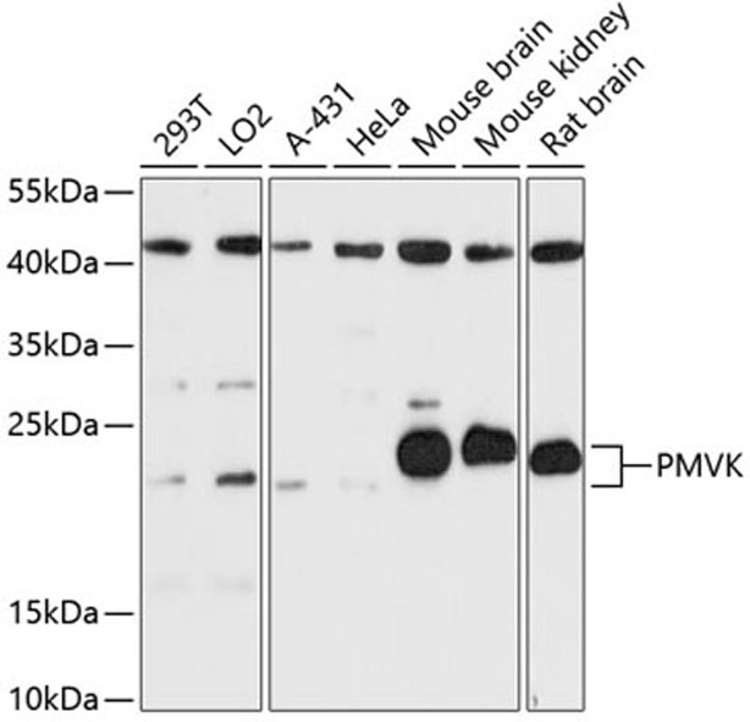 Western blot - PMVK antibody (A13865)