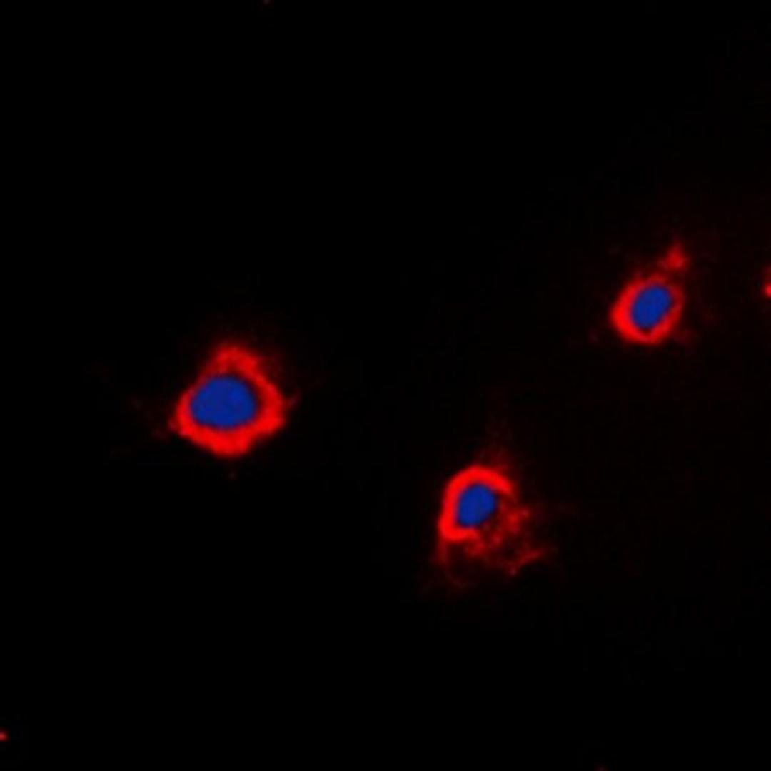 Immunofluorescense analysis of A549 cells using PTTG1IP antibody