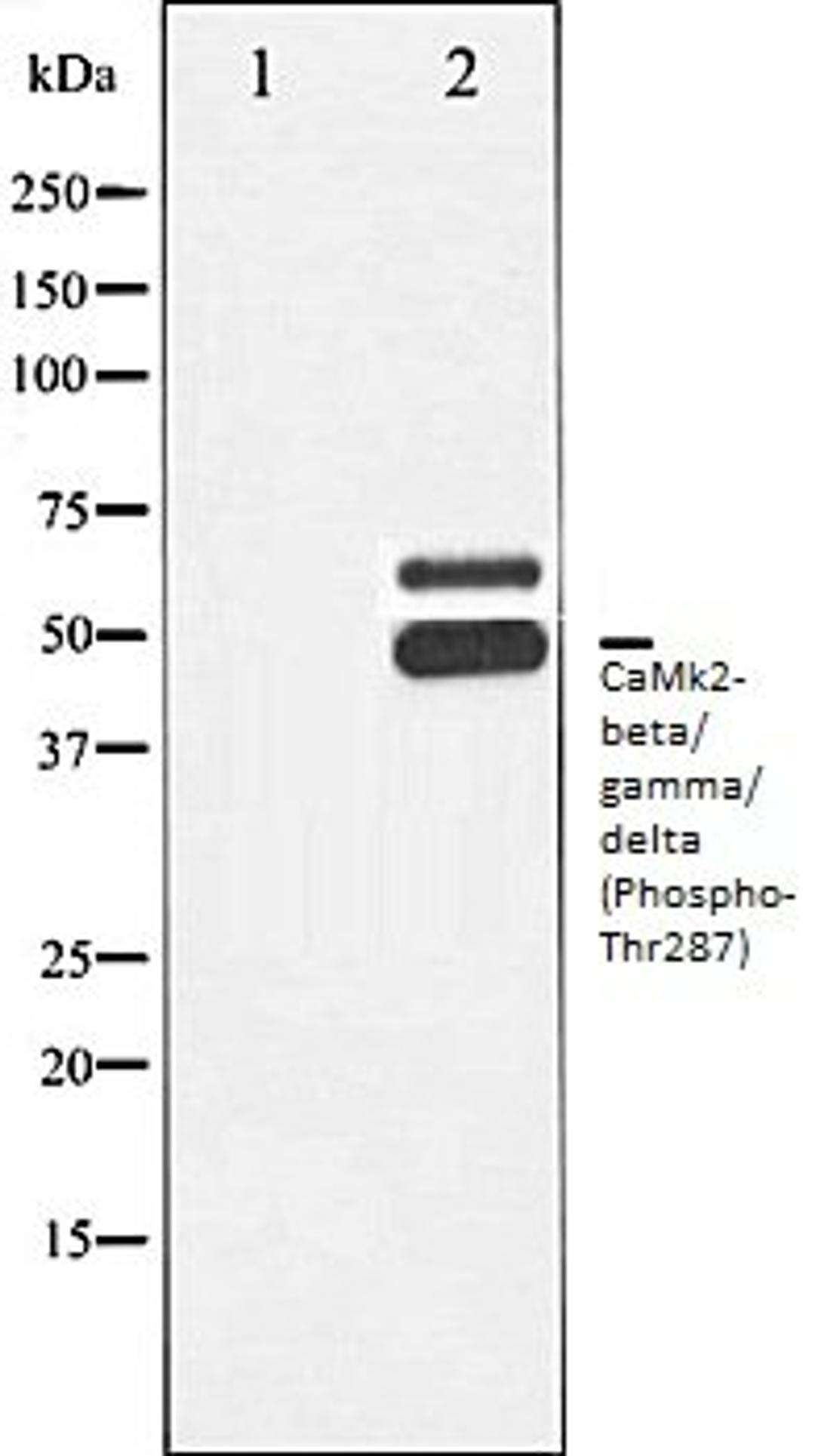 Western blot analysis of Rat brain tissue lysates using CaMK2- beta/ gamma/ delta (Phospho-Thr287) antibody, The lane on the left is treated with the antigen-specific peptide.