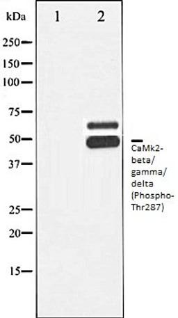 Western blot analysis of Rat brain tissue lysates using CaMK2- beta/ gamma/ delta (Phospho-Thr287) antibody, The lane on the left is treated with the antigen-specific peptide.