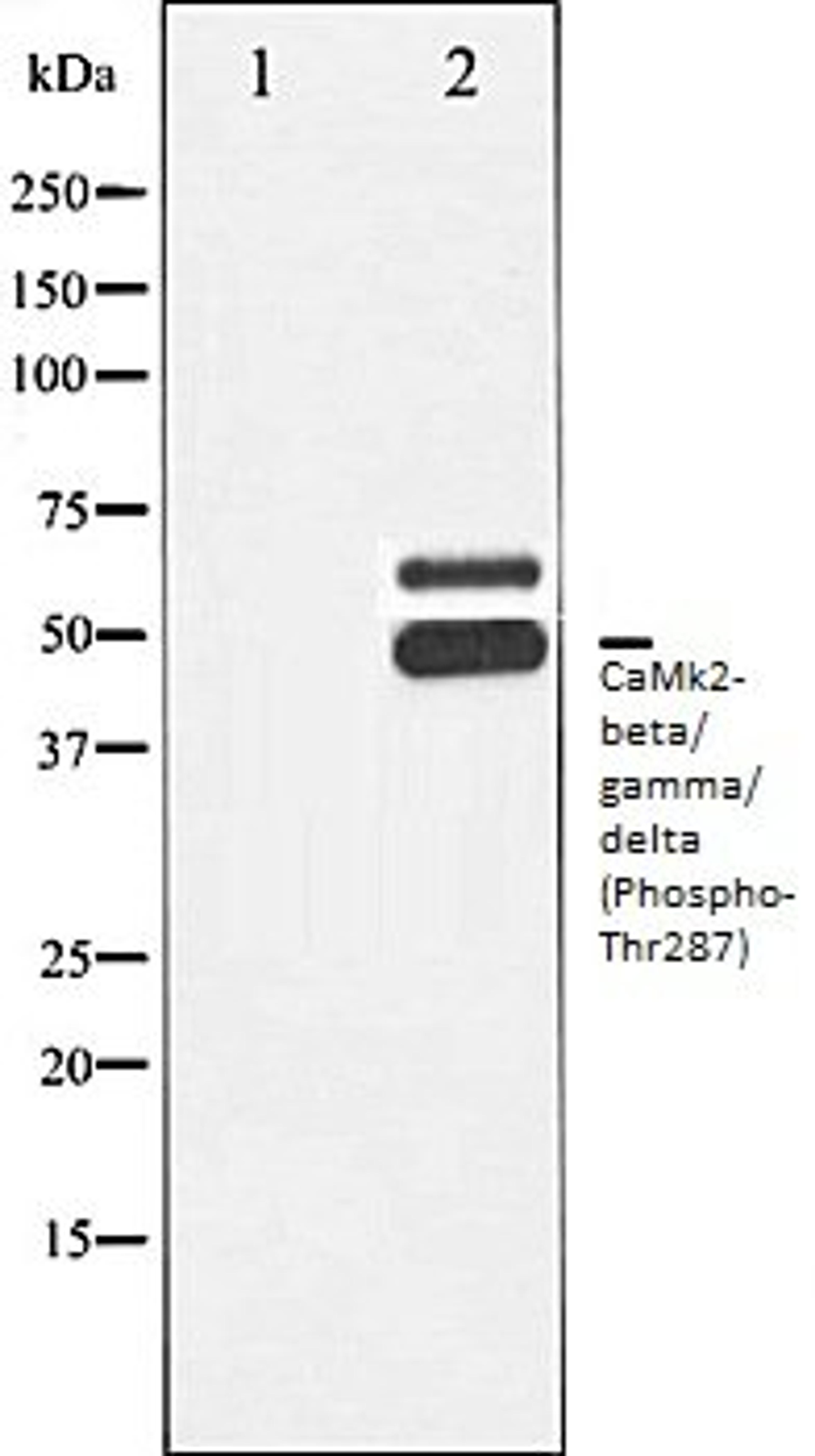 Western blot analysis of Rat brain tissue lysates using CaMK2- beta/ gamma/ delta (Phospho-Thr287) antibody, The lane on the left is treated with the antigen-specific peptide.