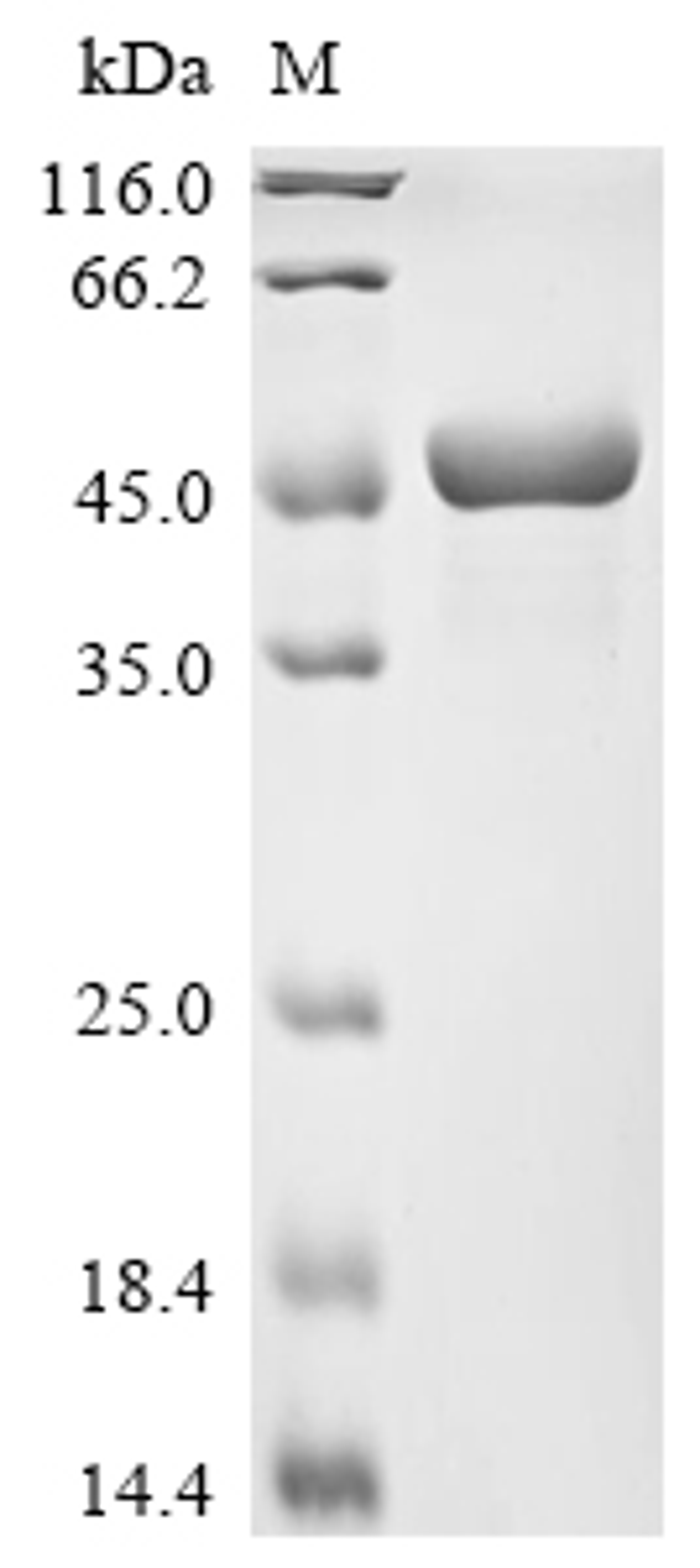 (Tris-Glycine gel) Discontinuous SDS-PAGE (reduced) with 5% enrichment gel and 15% separation gel.