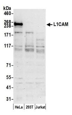 Detection of human L1CAM by western blot.