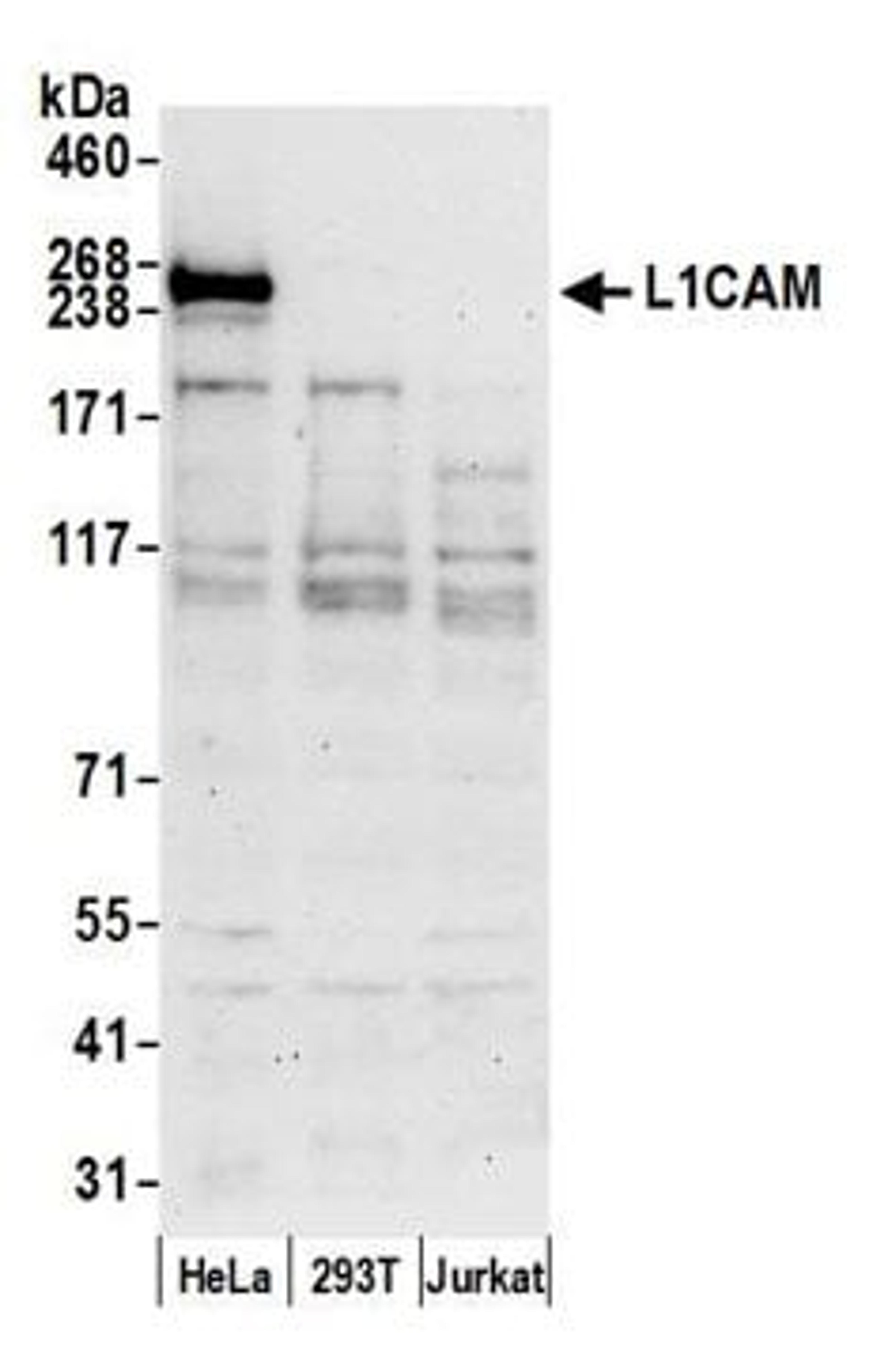 Detection of human L1CAM by western blot.