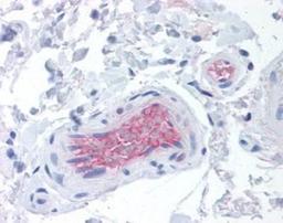 Immunohistochemistry-Paraffin: Complement Factor I Antibody (OX-21) [NBP1-02915] - Staining of human colon, vessels. Immunohistochemistry of formalin-fixed, paraffin-embedded tissue after heat-induced antigen retrieval. Antibody concentration 20 ug/ml.