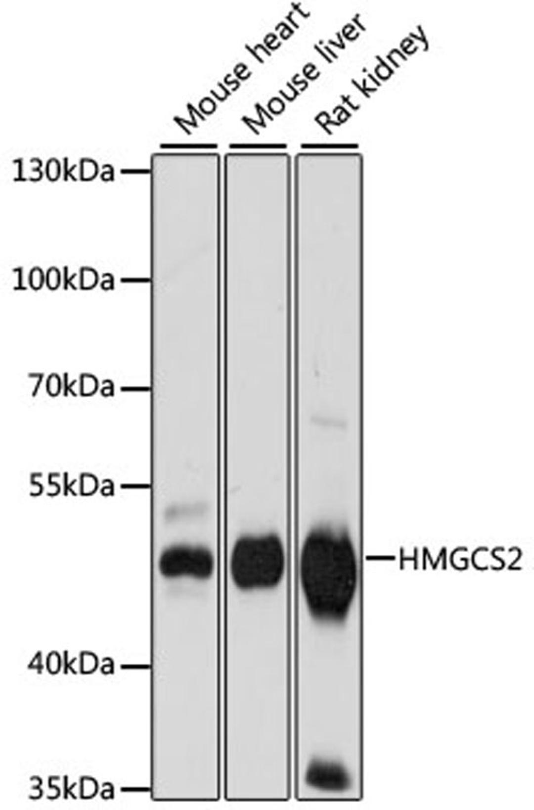 Western blot - HMGCS2 antibody (A14244)