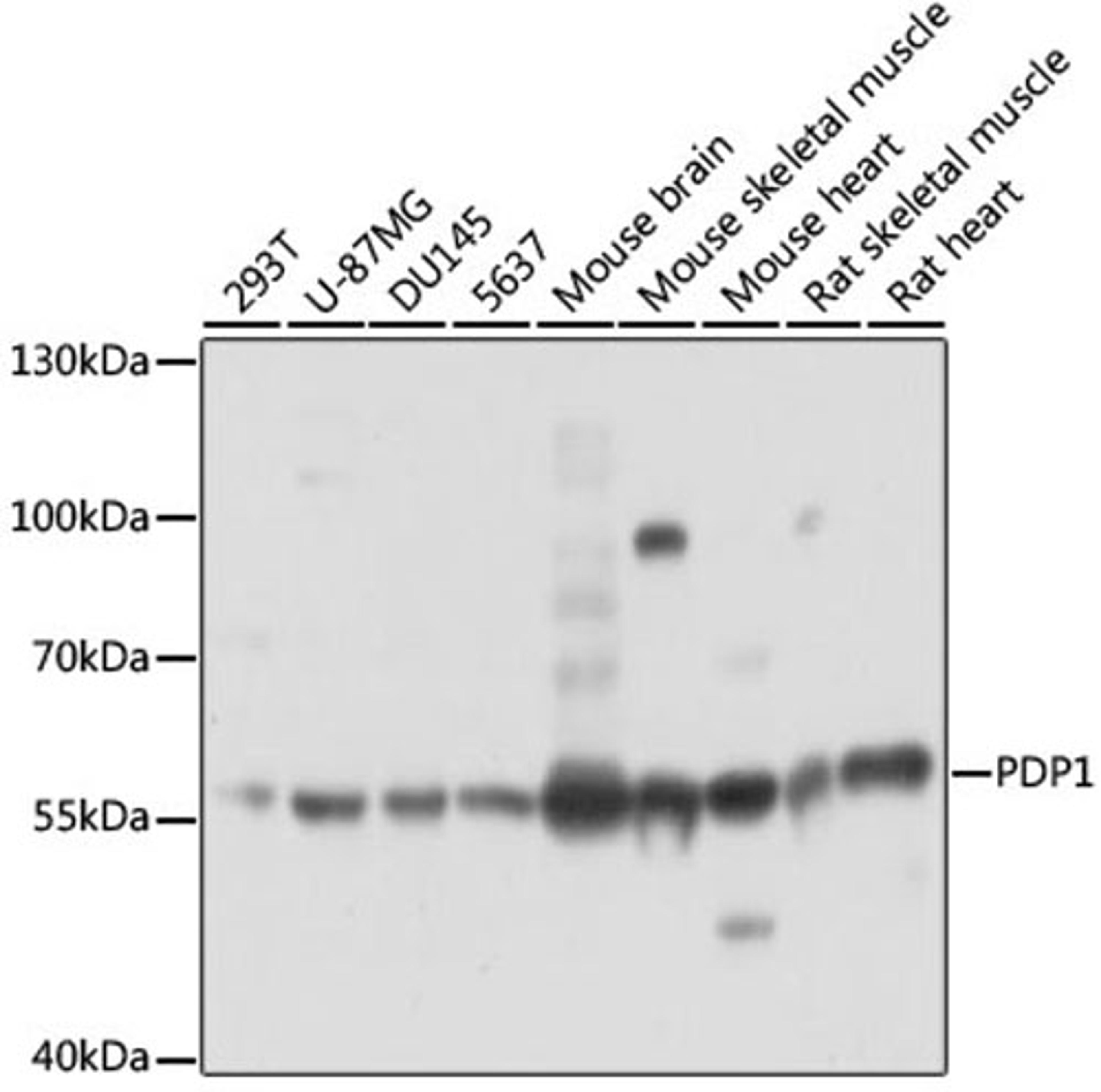 Western blot - PDP1 antibody (A14545)