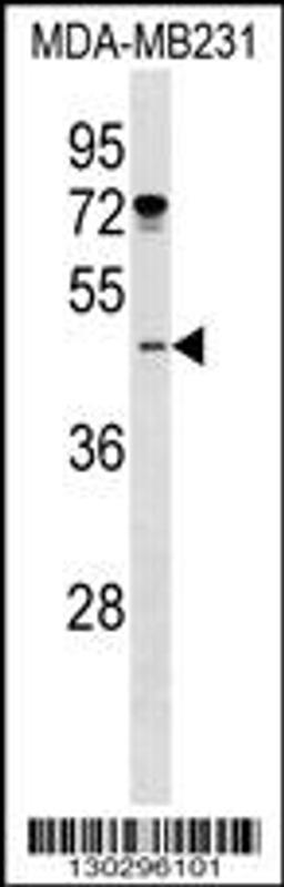 Western blot analysis in MDA-MB231 cell line lysates (35ug/lane).