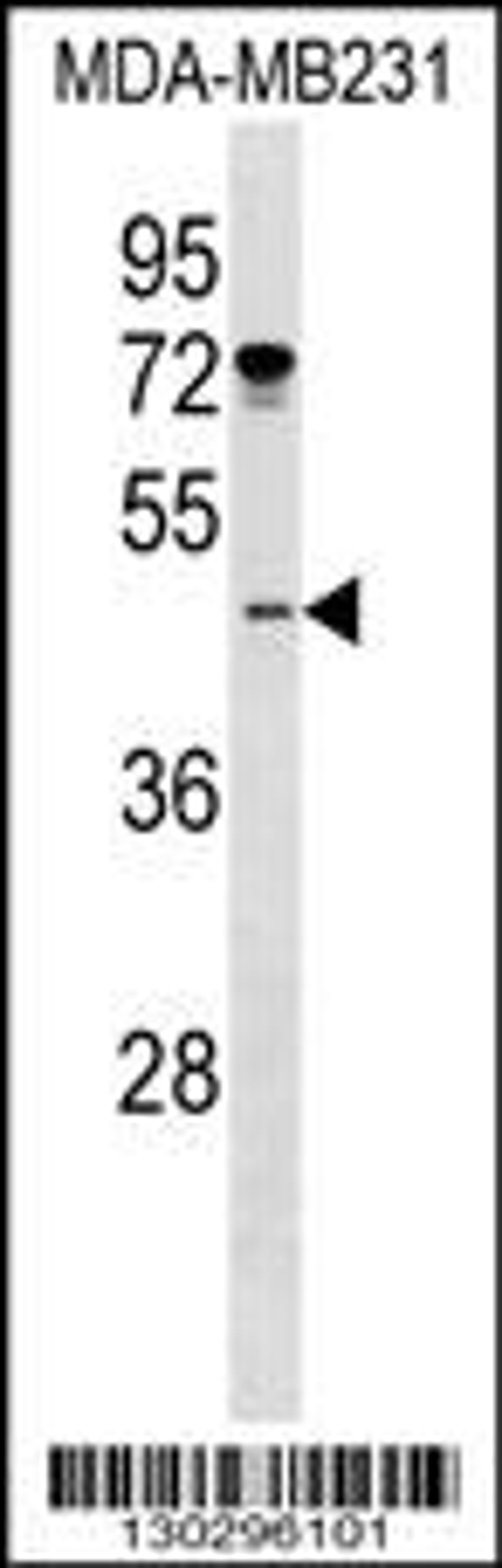 Western blot analysis in MDA-MB231 cell line lysates (35ug/lane).