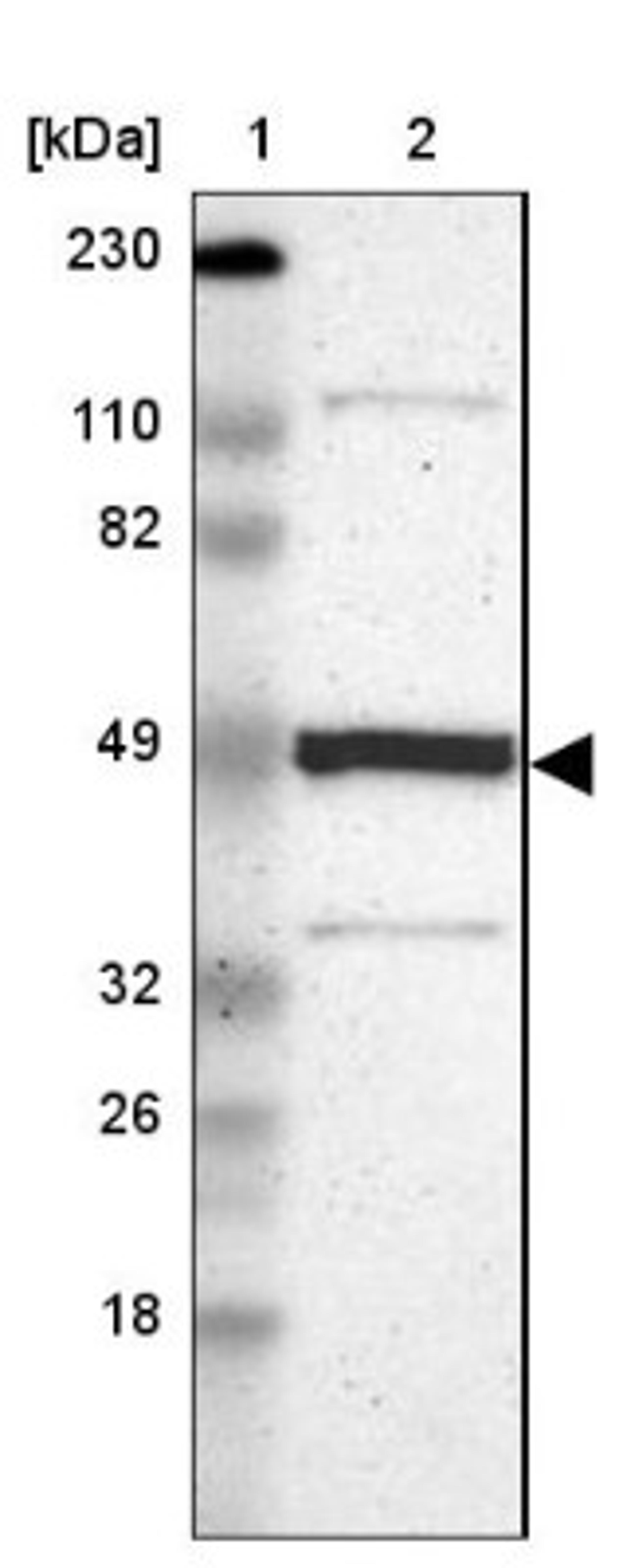 Western Blot: Njmu-R1 Antibody [NBP1-82563] - Lane 1: Marker [kDa] 230, 110, 82, 49, 32, 26, 18<br/>Lane 2: Human cell line RT-4