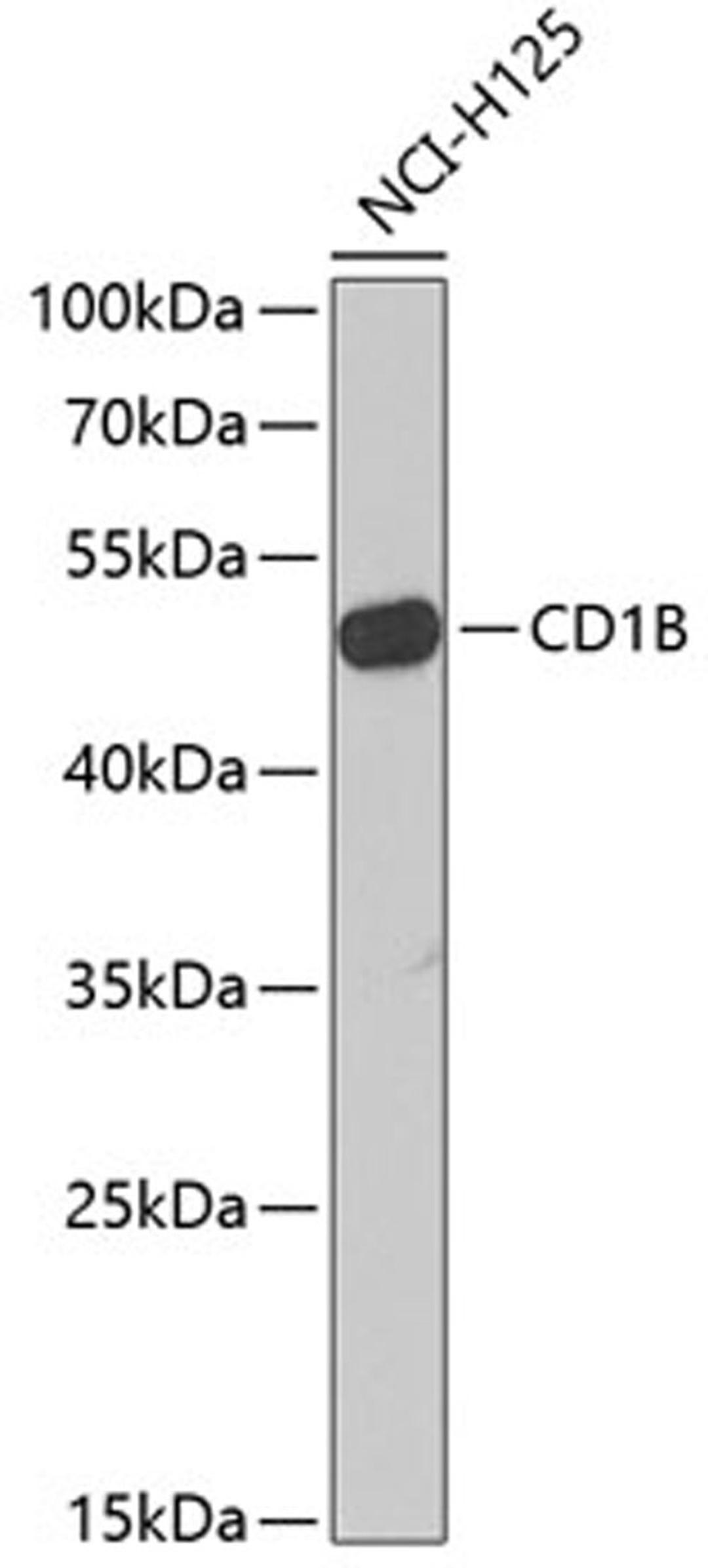 Western blot - CD1B Antibody (A6551)