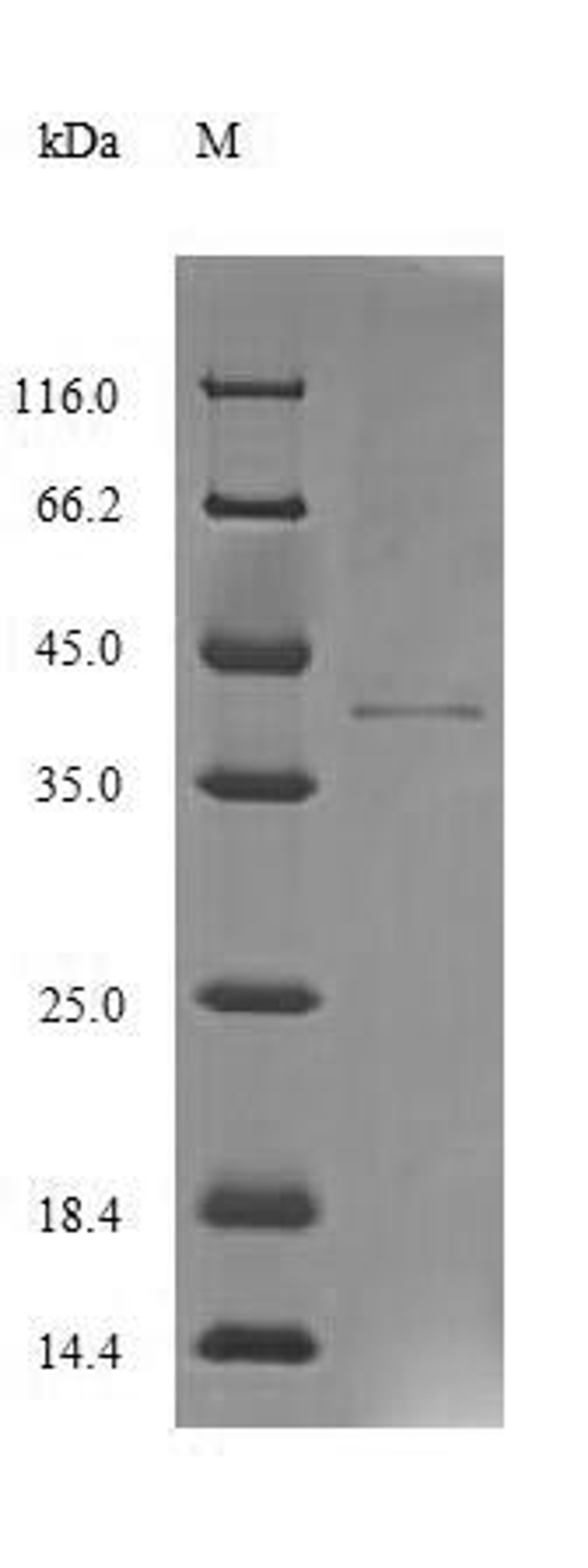 (Tris-Glycine gel) Discontinuous SDS-PAGE (reduced) with 5% enrichment gel and 15% separation gel.