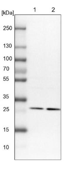 Western Blot: StAR Antibody [NBP1-86992] - Lane 1: NIH-3T3 cell lysate (Mouse embryonic fibroblast cells)<br/>Lane 2: NBT-II cell lysate (Rat Wistar bladder tumour cells)